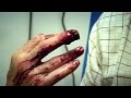 Circular saw accident part 1  bizarre er