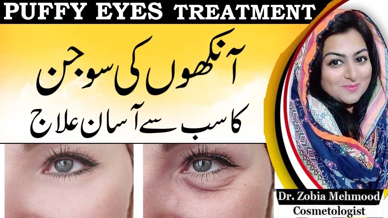 How To Get Rid Of Puffy Eyes Naturally In Urdu YouTube