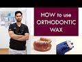 HOW to use Orthodontic Wax  |  Dr. Jiten Vadukul  |  The Orthodontist