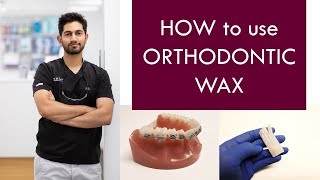 HOW to use Orthodontic Wax  |  Dr. Jiten Vadukul  |  The Orthodontist