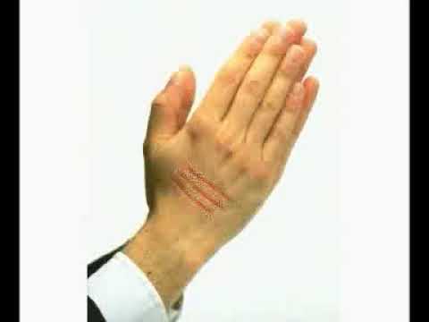 انواع الجروح 1 