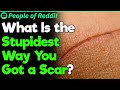 What Is Your Stupidest Scar Story? | People Stories #320