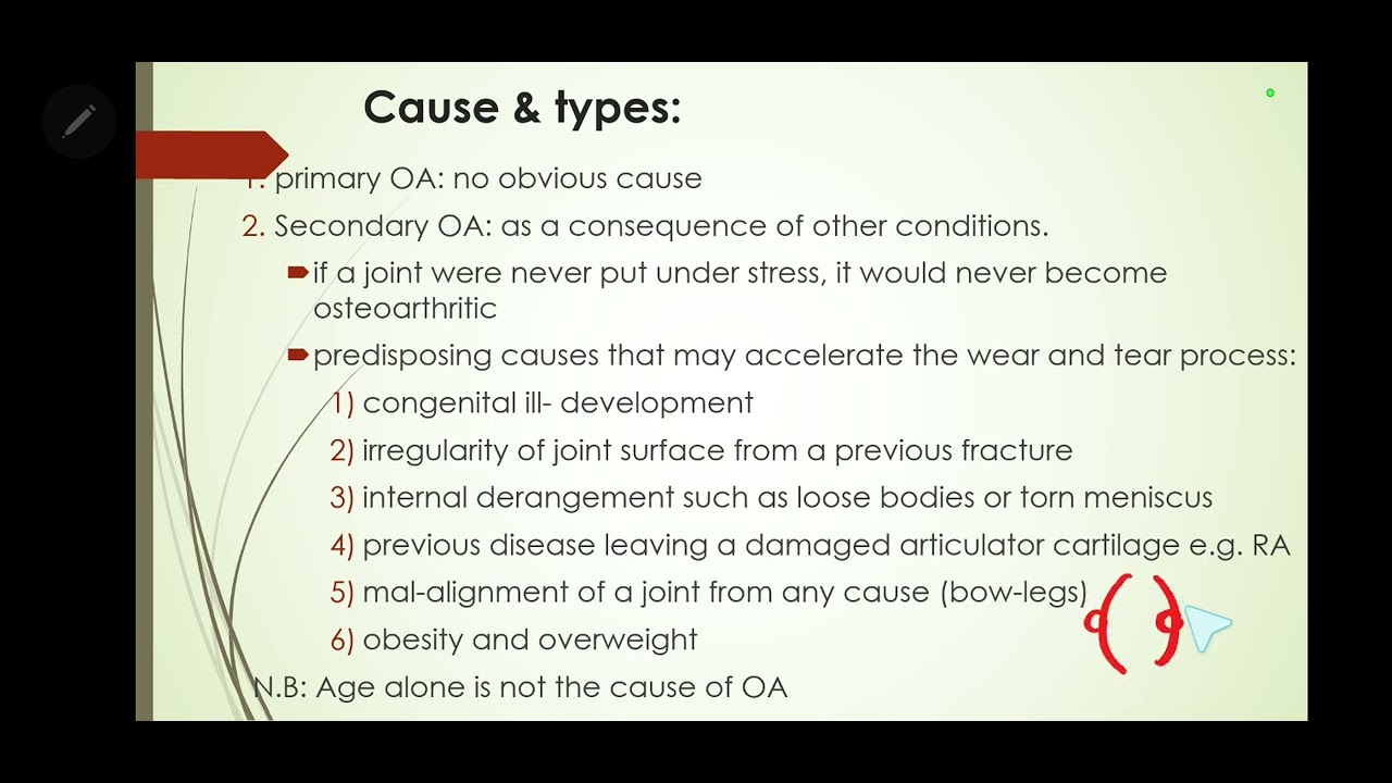 Osteoarthritis (OA) - Knee OA and Hand OA