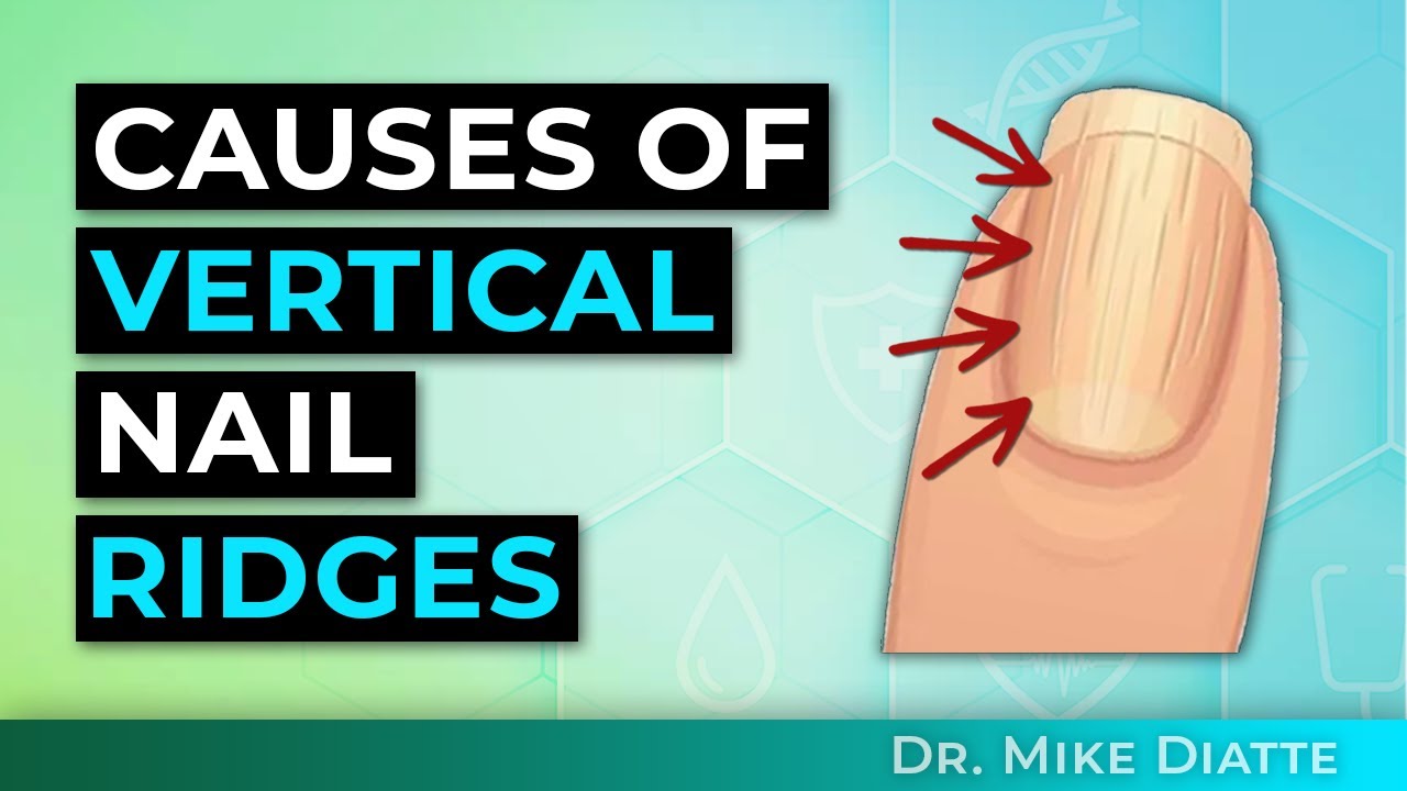Examples of vertical fingernail due to aging. | Nail ridges, Nail  disorders, Fingernails