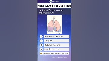 NEET MDS | INI-CET MDS | PSC | BDS - Most Important Questions  #neetmds2025 #mdsprep