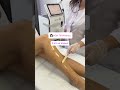 Лазерная эпиляция на аппаратах от компании LaserSkin. Только качественное оборудование !