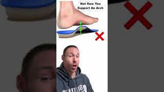 Do You Have Flat Feet?