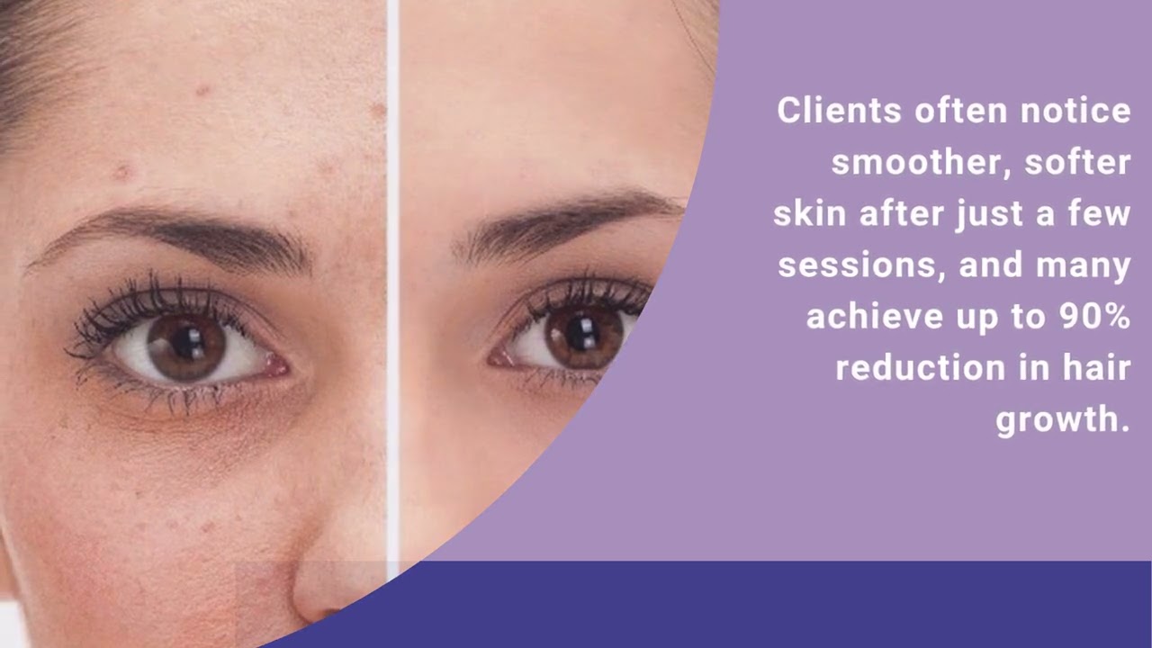 The Benefits of El Paso Permanent Hair Removal at American Laser Med Spa