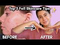 Top 5 Fall Skincare Tips that will transform your skin! 💎