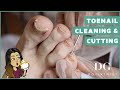 Toenail Cleaning and Cutting