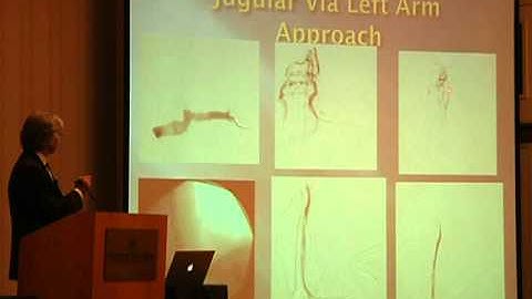 Dr. Gooding Lecture Part 3 - Hubbard Foundation 2011 CCSVI Conference