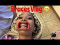 First Vlog | Getting My Braces Put On 😁
