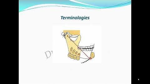 Occlusion   Understanding Basics