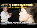 Для чего нужно исправлять лицевую асимметрию?