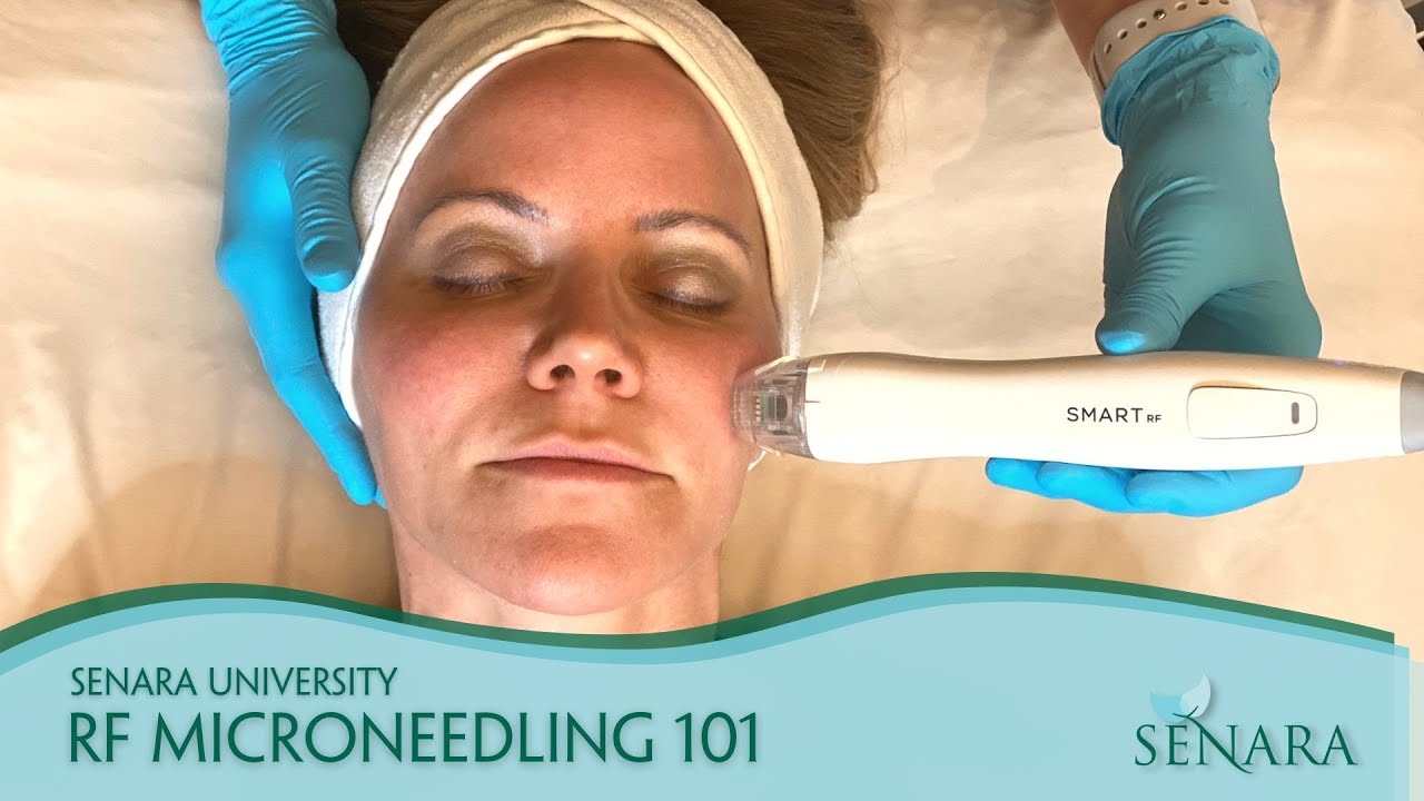 RF Microneedling 101 | Senara Health and Healing Center & Spa