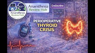 Perioperative Thyroid Crisis | Endocrine | Anaesthesia Review Hub