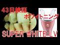 【検証】４３日間　ホワイトニング　SUPER WHITE LV