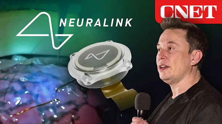 Elon Musk's Neuralink Event: Everything Revealed in 10 Minutes