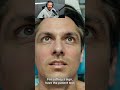 Thyroid Surgery-Eye Signs,#Surg revision,#med ed#Medical, # doctor#MBBS# Exam-prep,#@Successmentor