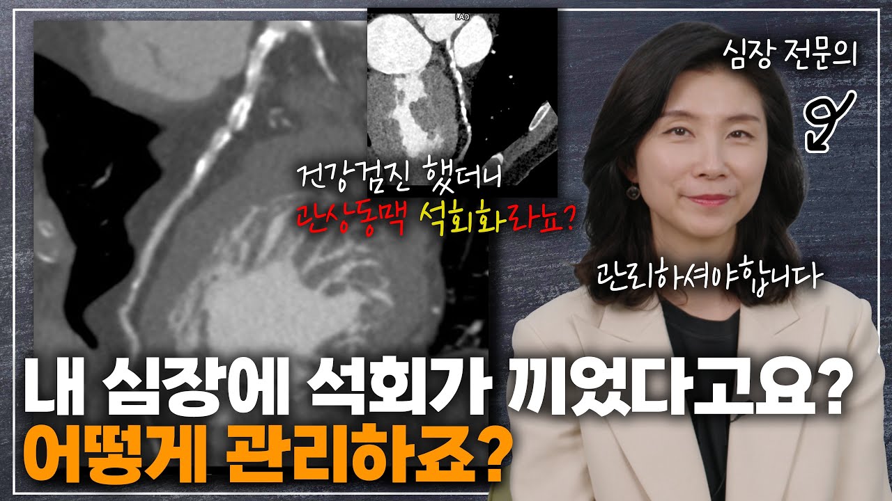 심장혈관에 석회화가 있다고 들은 분, 다 모여보세요! 관상동맥 석회화에 대한 설명과 치료에 대하여 알려드립니다