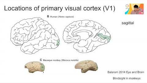 Wk 4-3 Can we simulate blindsight in monkeys?