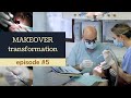 TEETH DENTAL CLEANING. Makeover transformation. Ep 5.