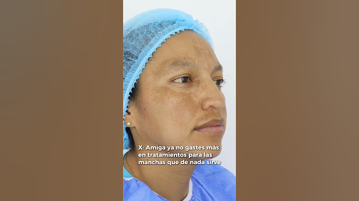 TRATAMIENTO PARA ELIMINAR LAS MANCHAS DEL ROSTRO