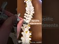 The Integrator Chiropractic Adjusting Tool 
