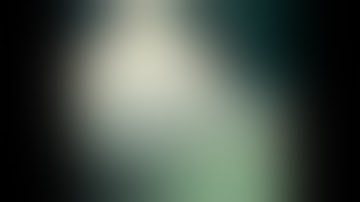 BSSO and Lefort one Osteotomy - Orthognathic jaw surgery @ Richardsons