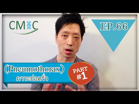 ภาวะปอดรั่ว: Part 1 (Pneumothorax) โดยนายแพทย์จักรีวัชร