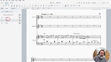 Repeating system markings above other staves