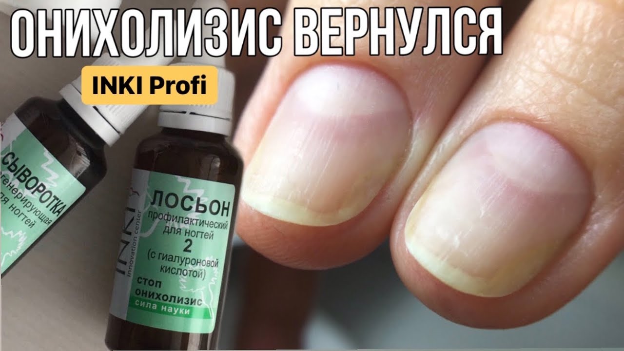 Онихолизис лекарство купить