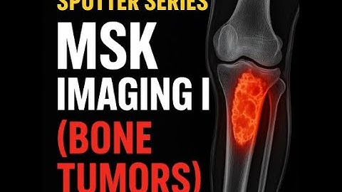 Spotter Series: MSK Imaging I (Bone tumors)