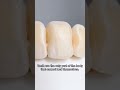 Teeth #didyouknow #levelup #knowledge #viral #teeth h
