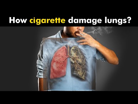 How Cigarettes Smoking Damages Lungs? (Urdu/Hindi)