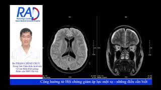 Diagnosis of Intracranial Hypertension - What You Need to Know