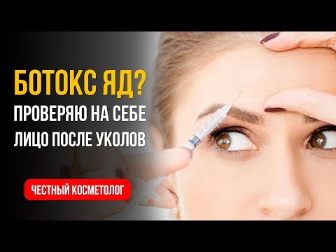 BOTOX IS A POISON? OPINION after INJECTIONS of the FACE. Disport, Kseomin the whole truth.
