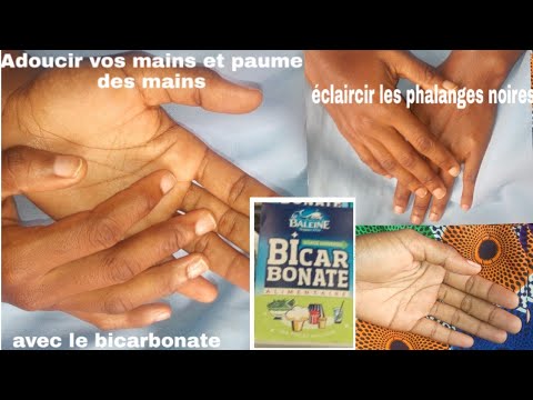 Vidéo: Comment Restaurer Les Mains