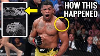 Gilbert Burns Horrific Shoulder Injury vs Belal Muhammad -Doctor Explains Multiple Injuries