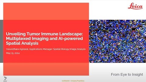 Unveiling Tumor Immune Landscape: Using Multiplexed Whole-Tissue Imaging and AI-Powered...