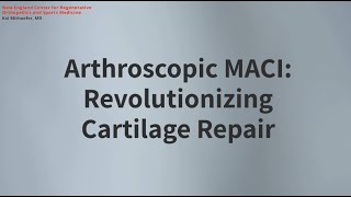 Arthroscopic MACI: Revolutionizing Cartilage Repair