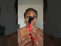 Microneeding My Scalp/Alopecia Spots #hair #beauty #alopecia