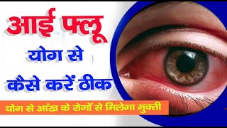 eye flu yog se kaise thik kare | योग से आई फ्लू का इलाज कैसे करें | Bmt Yogi