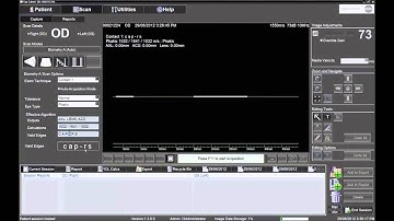 Performing Contact Biometry with the Ellex Eye Cubed