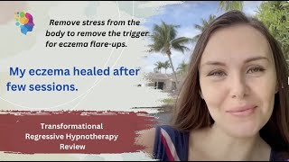 Eczema Healing with Transformational Hypnotherapy