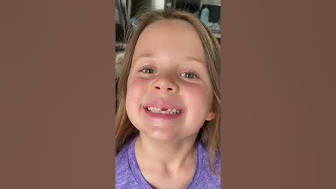 You won’t believe how her tooth came out! #shorts #amazing #themccartys