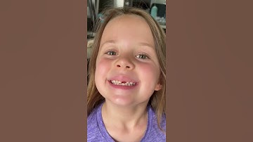 Thumbnail of You won’t believe how her tooth came out! #shorts #amazing #themccartys