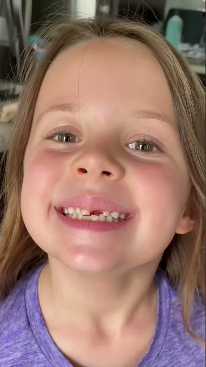 You won’t believe how her tooth came out! #shorts #amazing #themccartys