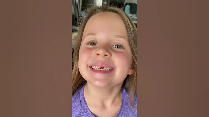 You wont believe how her tooth came out! #shorts #...