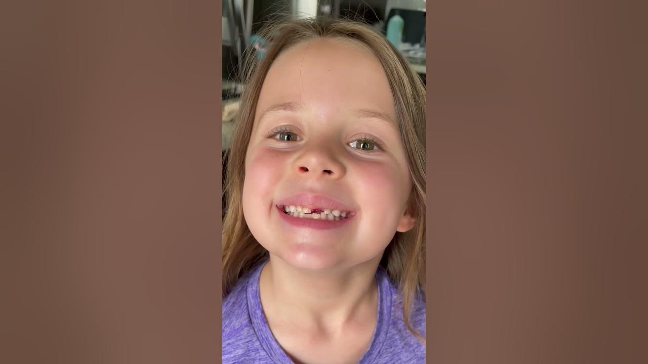 You won’t believe how her tooth came out! #shorts #amazing #themccartys